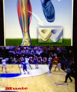 Don't watch if your squeamish!