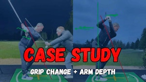 Arm Depth - Case Study
